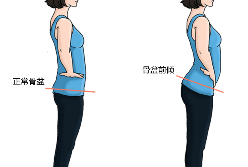 八字胸是什么导致的_八字胸是不是不好_八字胸的图片