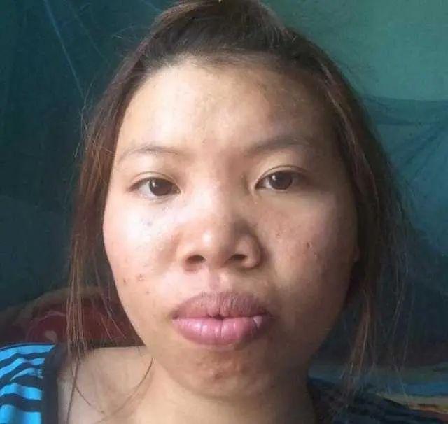 凤姐整容后的漂亮照片_凤姐 整容 前后_整容凤姐前后对比照