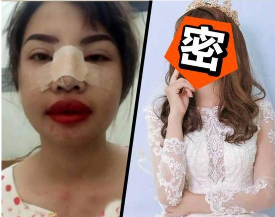 凤姐整容后的漂亮照片_整容凤姐前后对比照_凤姐 整容 前后