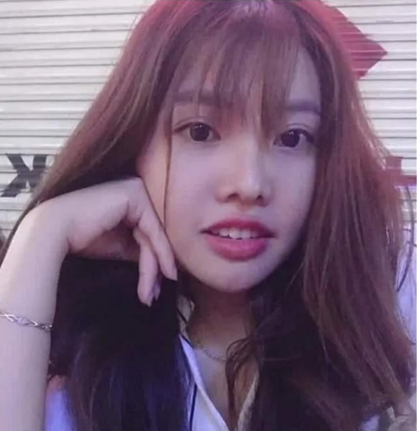 凤姐 整容 前后_整容凤姐前后对比照_凤姐整容后的漂亮照片