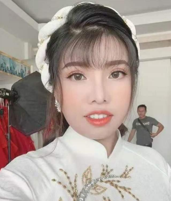 凤姐整容后的漂亮照片_整容凤姐前后对比照_凤姐 整容 前后