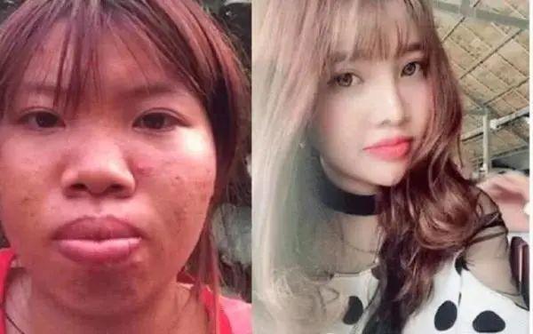 整容凤姐前后对比照_凤姐整容后的漂亮照片_凤姐 整容 前后