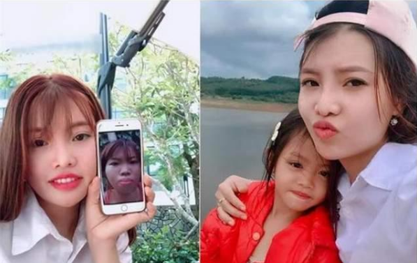 凤姐整容后的漂亮照片_凤姐 整容 前后_整容凤姐前后对比照