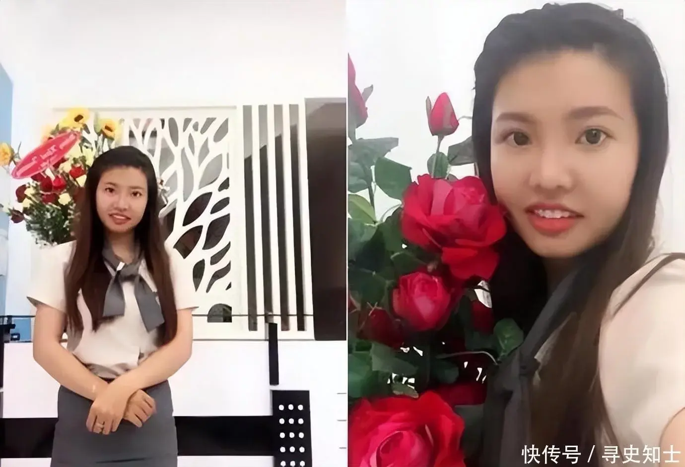 凤姐 整容 前后_整容凤姐前后对比照_整容凤姐前后照片